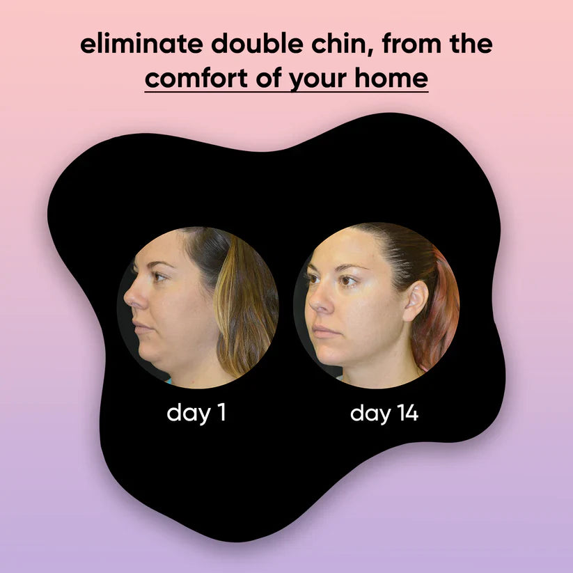 illume - 4 in 1 facial sculptor